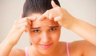 How to Prevent Pimples