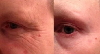 How To Find A Good Facial Wrinkle Cream