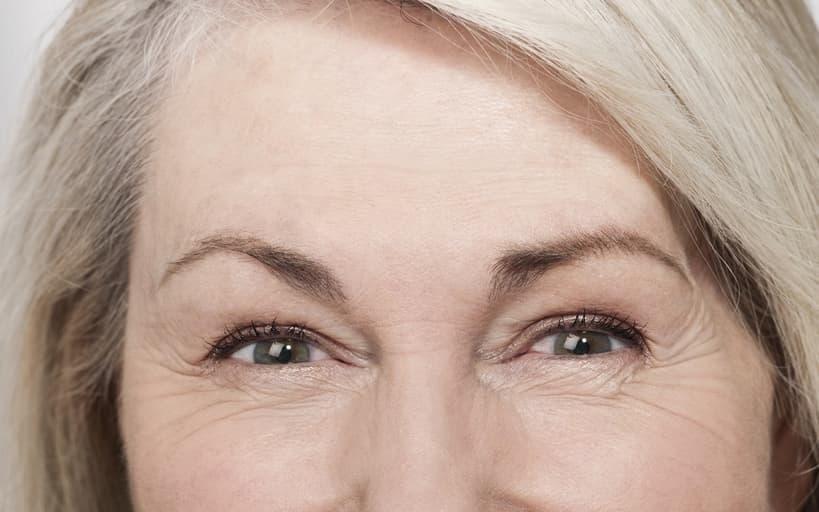Treatment For Eyelid Wrinkles