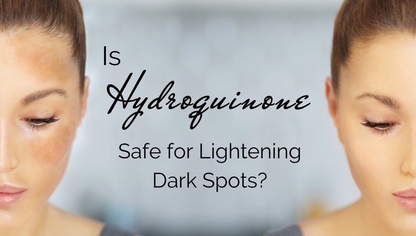 Is Hydroquinone safe in your Skin Cream