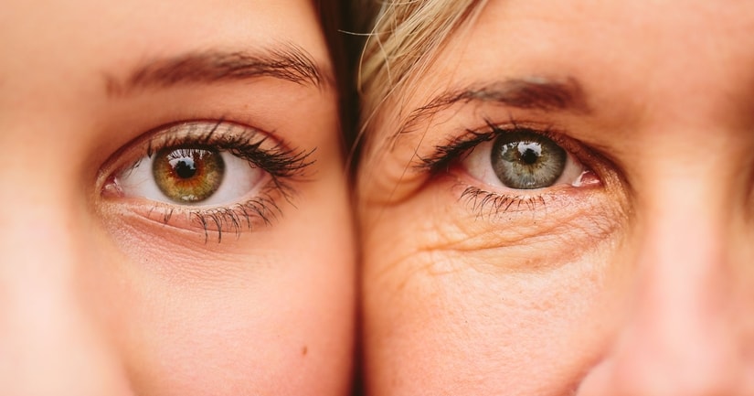Prevent Eye Wrinkles - 10 Tips